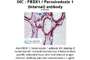 Image no. 2 for anti-Peroxiredoxin 1 (PRDX1) (Internal Region) antibody (ABIN1738319) (Peroxiredoxin 1 anticorps  (Internal Region))