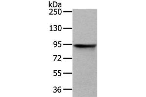 Gel: 6 % SDS-PAGE, Lysate: 40 μg, Lane: HT-29 cell, Primary antibody: ABIN7128081(VIL1 Antibody) at dilution 1/250 dilution, Secondary antibody: Goat anti rabbit IgG at 1/8000 dilution, Exposure time: 3 seconds (Villin 1 anticorps)