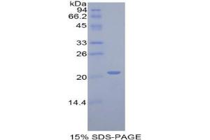 SDS-PAGE analysis of Rat ARPC4 Protein.