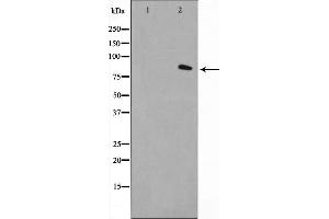 Western blot analysis on LOVO cell lysate using FAP-1 Antibody，The lane on the left is treated with the antigen-specific peptide. (FAP anticorps  (Internal Region))