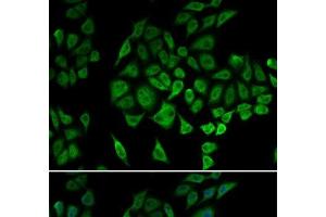 Immunofluorescence analysis of U2OS cells using NDUFS1 Polyclonal Antibody