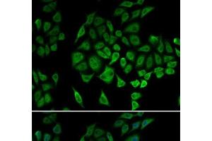 Immunofluorescence analysis of U2OS cells using NDUFS1 Polyclonal Antibody (NDUFS1 anticorps)