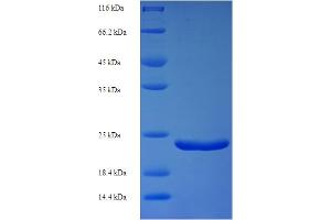 SDS-PAGE (SDS) image for Lymphocyte Antigen 6 Complex, Locus E (LY6E) (AA 21-101) protein (His-SUMO Tag) (ABIN5711281)