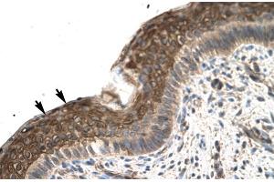Rabbit Anti-ZFP1 Antibody Catalog Number: ARP31586 Paraffin Embedded Tissue: Human Spermatophore Cellular Data: Epithelial cells Antibody Concentration: 4. (Zfp-1 anticorps  (N-Term))
