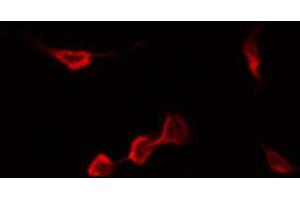 ABIN6267548 staining Hela by IF/ICC. (CCR5 anticorps  (pSer336))