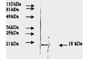 Western Blotting (WB) image for anti-Fibroblast Growth Factor 2 (Basic) (FGF2) antibody (ABIN452472) (FGF2 anticorps)