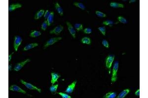 Immunofluorescent analysis of Hela cells using ABIN7175250 at dilution of 1:100 and Alexa Fluor 488-congugated AffiniPure Goat Anti-Rabbit IgG(H+L)