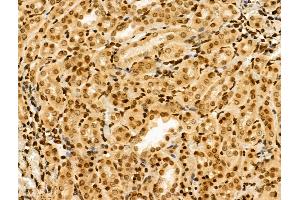 ABIN6257333 and ABIN6274335 at 1/100 staining Rat kidney tissue by IHC-P. (MTA1 anticorps  (Internal Region))