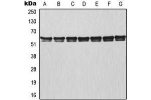 Western blot analysis of TRAF3 expression in MCF7 (A), HeLa (B), Raji (C), NIH3T3 (D), mouse lung (E), rat colon (F), PC12 (G) whole cell lysates. (TRAF3 anticorps  (Center))