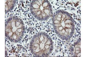 Image no. 7 for anti-Chromosome 2 Open Reading Frame 62 (C2orf62) antibody (ABIN1497054) (C2orf62 anticorps)