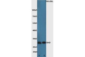 Lane 1:Mouse kidney lysate Lane 2: Mouse brain lysate probed with Rabbit Anti-Bad Polyclonal Antibody, Unconjugated (ABIN674709) at 1:300 overnight at 4 °C.
