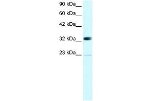 WB Suggested Anti-CBX4 Antibody Titration: 0. (CBX4 anticorps  (N-Term))