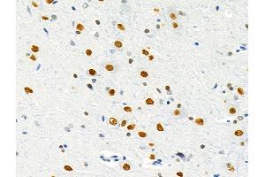 ABIN6257236 and ABIN6275800 at 1/100 staining Rat brain tissue by IHC-P. (GATA6 anticorps  (Internal Region))