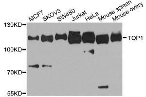 Western blot analysis of extracts of various cell lines, using TOP1 antibody. (Topoisomerase I anticorps  (AA 1-100))