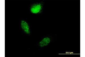 Immunofluorescence of monoclonal antibody to S100A4 on HeLa cell. (s100a4 anticorps  (AA 1-101))