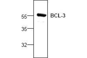 Image no. 1 for anti-B-Cell CLL/lymphoma 3 (BCL3) antibody (ABIN127088) (BCL3 anticorps)