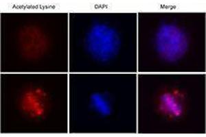anti-Acetylated Lysine (acetylated) antibody