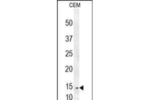 CRCT1 Antibody (N-term) (ABIN653986 and ABIN2843928) western blot analysis in CEM cell line lysates (35 μg/lane). (CRCT1 anticorps  (N-Term))