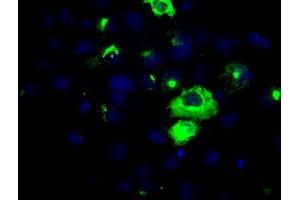 Image no. 5 for anti-Amyloid beta (A4) Precursor Protein (APP) antibody (ABIN1496879) (APP anticorps)