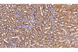 Detection of NME2 in Mouse Kidney Tissue using Polyclonal Antibody to Non Metastatic Cells 2, Protein NM23B Expressed In (NME2) (NME2 anticorps  (AA 8-149))