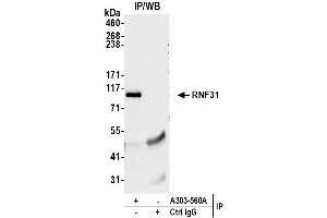 Immunoprecipitation (IP) image for anti-Ring Finger Protein 31 (RNF31) (AA 1022-1072) antibody (ABIN7449808) (RNF31 anticorps  (AA 1022-1072))