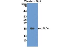 Western blot analysis of the recombinant protein. (VEGFA anticorps  (AA 27-145))