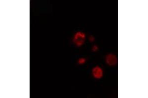 ABIN6274288 staining NIH-3T3 cells by IF/ICC. (LIMK2 anticorps  (Internal Region))