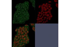 Immunofluorescence Analysis of MCF-7 cells using Mammaglobin Recombinant Rabbit Monoclonal Antibody (MGB/2682R) followed by goat anti-mouse IgG-CF488, counterstained with RedDot. (Recombinant Mammaglobin A anticorps)