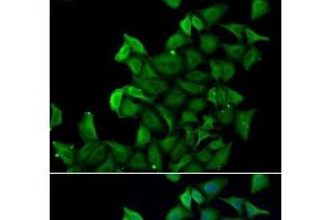Immunofluorescence analysis of A549 cells using FABP5 Polyclonal Antibody (FABP5 anticorps)