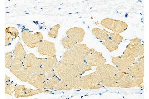 ABIN6266271 and ABIN6277433 at 1/100 staining Rat skin tissue by IHC-P.