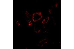 Immunofluorescence of SNAI2 in human kidney tissue with SNAI2 polyclonal antibody  at 20 ug/mL . (SLUG anticorps  (Internal Region))