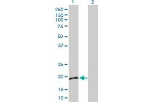 Western Blot analysis of IFNA16 expression in transfected 293T cell line by IFNA16 MaxPab polyclonal antibody.