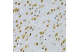 Immunohistochemistry of paraffin-embedded rat brain using ELAVL1 Antibody.