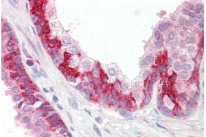 Human Prostate: Formalin-Fixed, Paraffin-Embedded (FFPE) (KEAP1 anticorps  (C-Term))