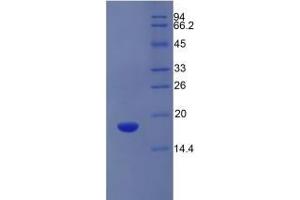 SDS-PAGE of Protein Standard from the Kit (Highly purified E.