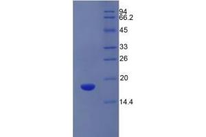 SDS-PAGE of Protein Standard from the Kit (Highly purified E. (SLC3A2 Kit ELISA)