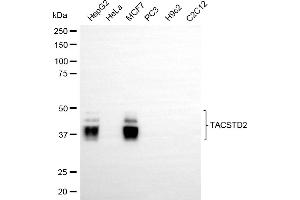 Western blotting analysis using TACSTD2 antibody (ABIN7800698).