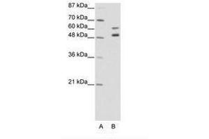 Image no. 1 for anti-Zinc Finger Protein 682 (ZNF682) (AA 35-84) antibody (ABIN202663) (ZNF682 anticorps  (AA 35-84))