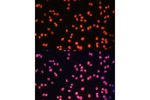 anti-Zinc Finger Protein 581 (ZNF581) (AA 1-90) antibody