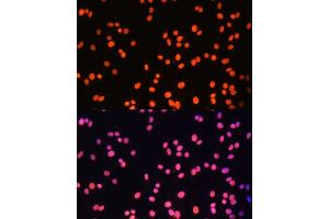Immunofluorescence analysis of C6 cells using ZNF581 Polyclonal Antibody (ABIN6128960, ABIN6150520, ABIN6150521 and ABIN6217055) at dilution of 1:100 (40x lens). (ZNF581 anticorps  (AA 1-90))