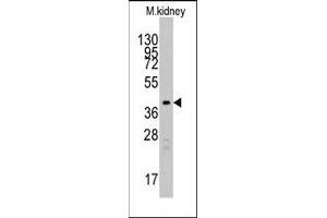 Western blot analysis of anti-TBRG1 Pab in mouse kidney tissue lysates (35ug/lane).
