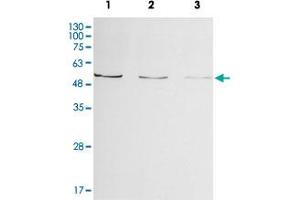Western blot analysis of Enpp2 from zebrafish embryo lysate by Enpp2 polyclonal antibody ( Cat # PAB8520 ) (1:500, 4°C, overnight). (ENPP2 anticorps)