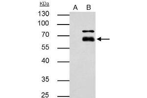 IP Image MMP8 antibody immunoprecipitates MMP8 protein in IP experiments.