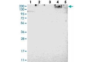 Western blot analysis of Lane 1: RT-4, Lane 2: U-251 MG, Lane 3: Human Plasma, Lane 4: Liver, Lane 5: Tonsil with SPTBN1 polyclonal antibody . (SPTBN1 anticorps)