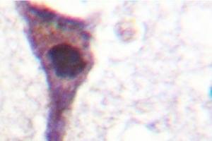 Image no. 2 for anti-Myosin Phosphatase, Target Subunit 1 (PPP1R12A) antibody (ABIN272043)