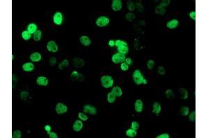 Immunofluorescence (IF) image for anti-Peptidyl Arginine Deiminase, Type IV (PADI4) antibody (ABIN1500017)