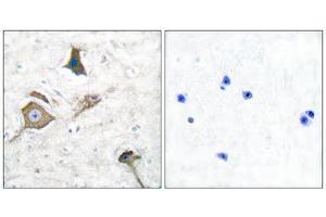 Immunohistochemistry (IHC) image for anti-Matrix Metallopeptidase 16 (Membrane-inserted) (MMP16) (C-Term) antibody (ABIN1848679) (MMP16 anticorps  (C-Term))