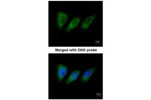 ICC/IF Image Immunofluorescence analysis of paraformaldehyde-fixed HeLa, using protein kinase N2, antibody at 1:200 dilution.