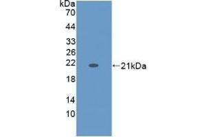 WB of Protein Standard: different control antibodies against Highly purified E.