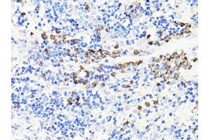Immunohistochemistry of paraffin-embedded rat spleen using S100A9 antibody. (S100A9 anticorps)